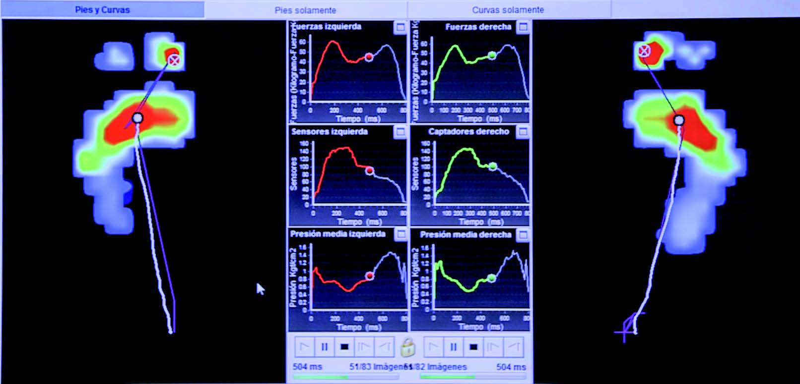 Imagen de ordenador de los resultados de un exament de biomecánica