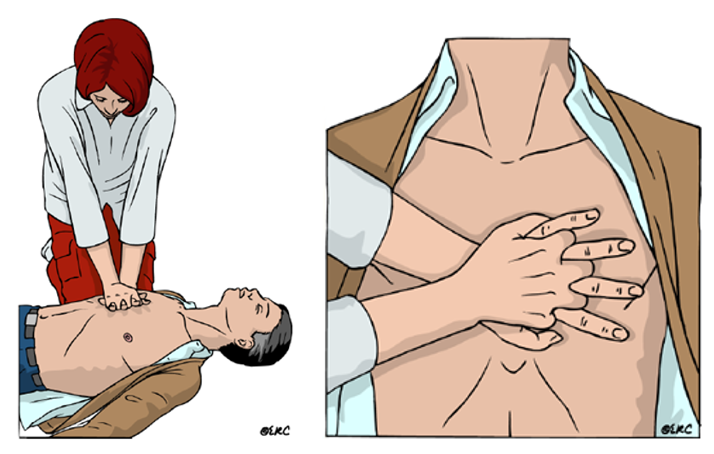 Thoracic compressions