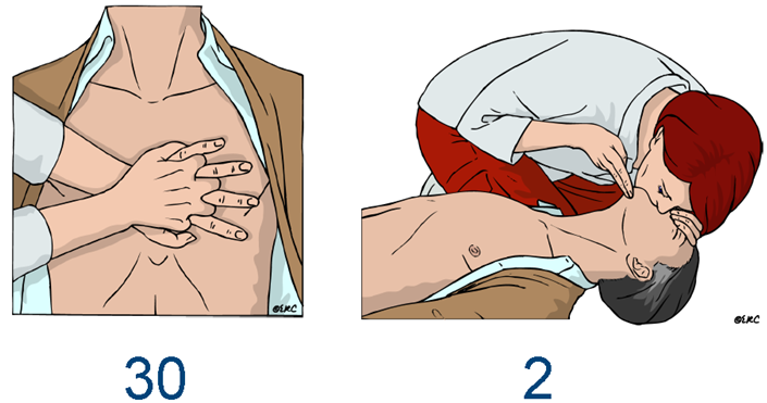 Back-up respirations