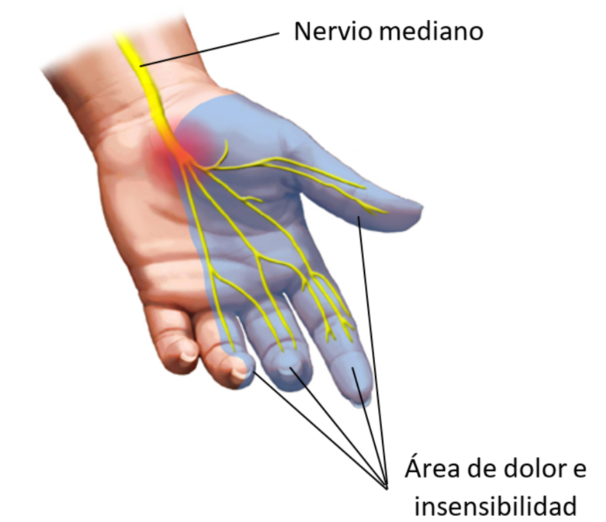 nervio mediano