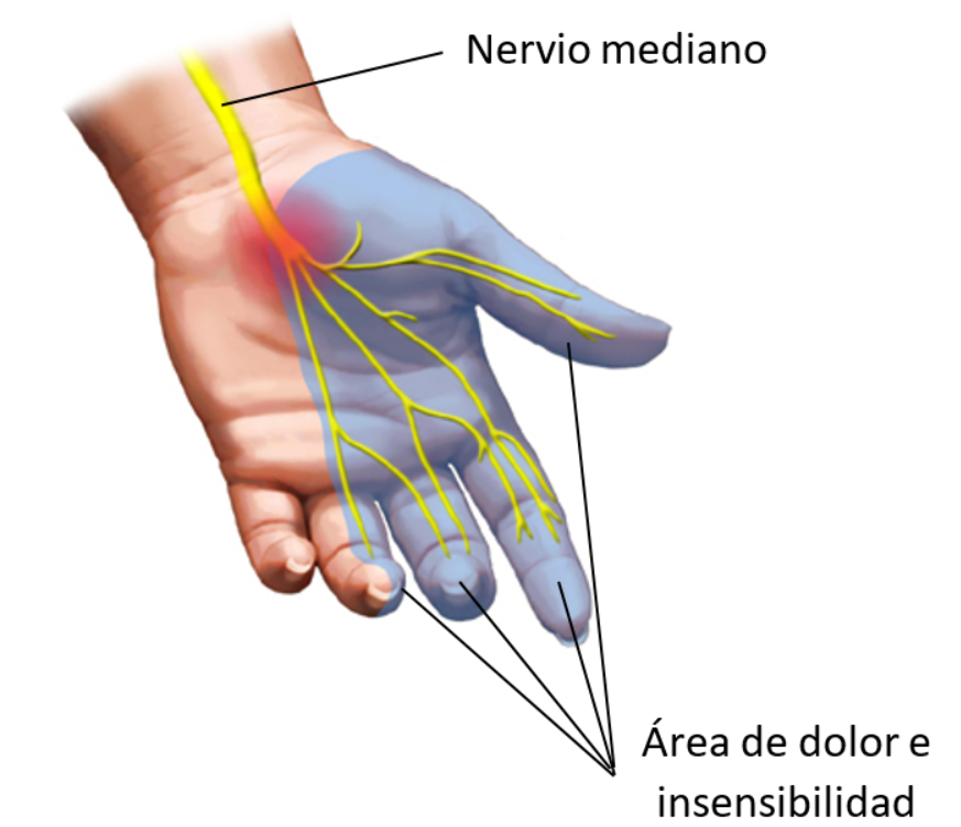 middling nerve